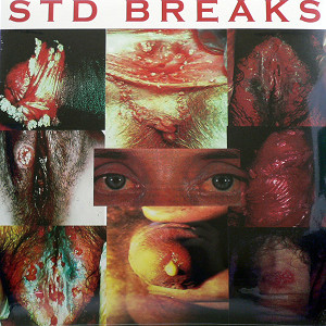 iڍ F yԃoguIzD-STYLES(LP) STD BREAKS